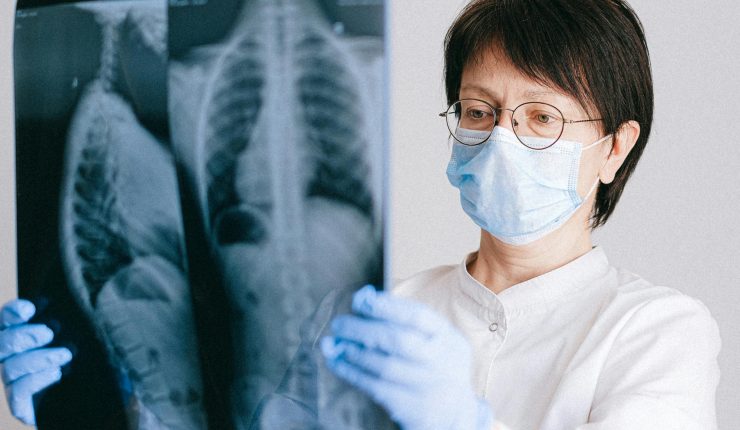 Cirujano de tórax aclara: ¿Cómo afecta el fumar a los pulmones?