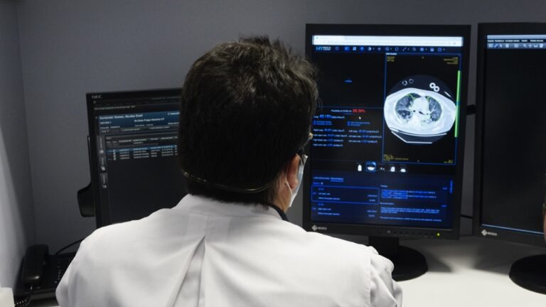 Telediagnóstico: Posta Central utiliza avanzado sistema para detectar el COVID- 19 sin examen PCR