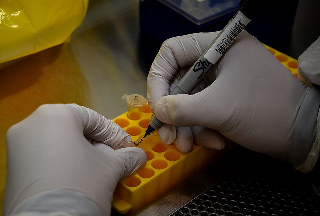 ISP confirmó cinco nuevos casos de la variante Delta en Chile