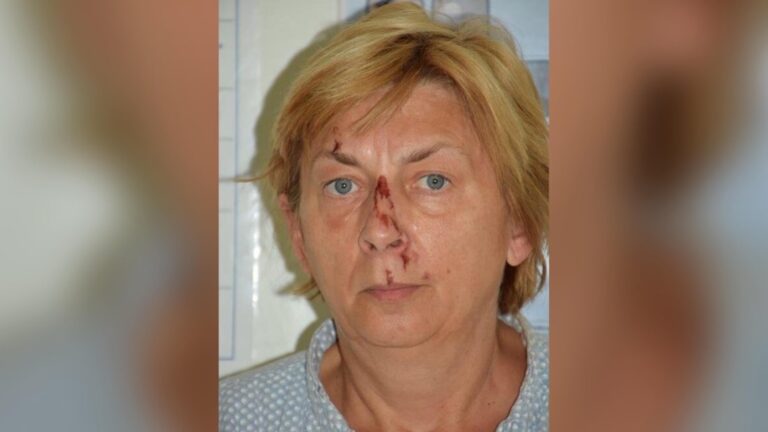 Encuentran a mujer herida en una isla de Croacia que no recuerda su nombre ni como llegó ahi