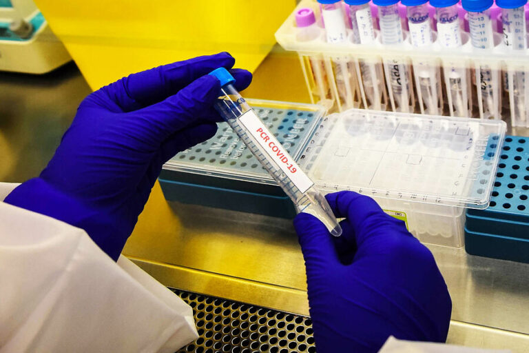 Informe Epidemiológico: Aysén, RM y Tarapacá registran las mayores tasas de incidencia de casos activos