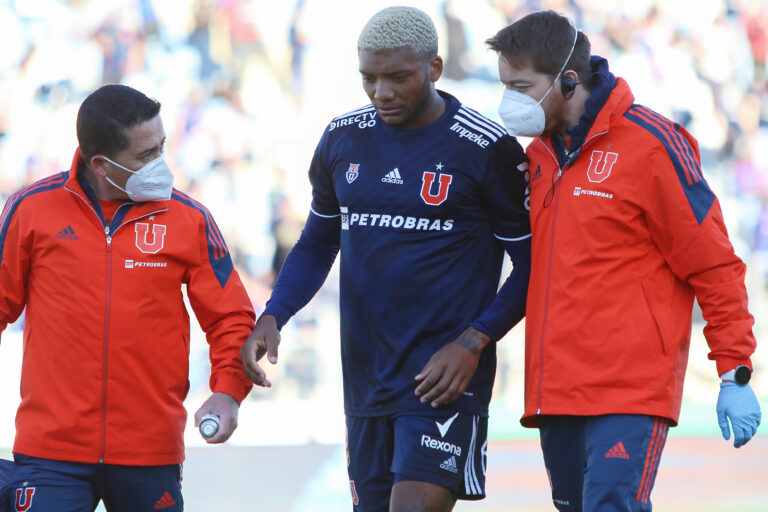 Junior Fernandes es la gran duda de la Universidad de Chile para su visita ante Cobresal