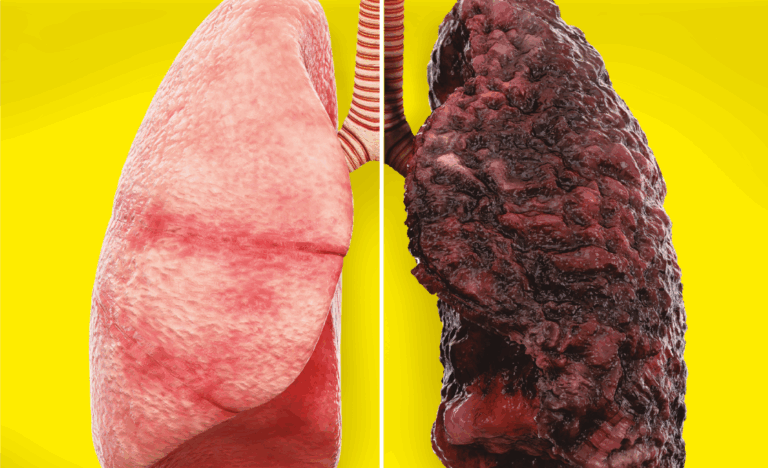 Día Mundial contra el Cáncer: Presentan nuevas advertencias en cajetillas de cigarros orientadas a menores de 13 y 14 años