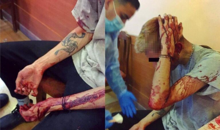 Movilh denuncia ataque homo transfóbico a jóvenes en restaurante de Providencia