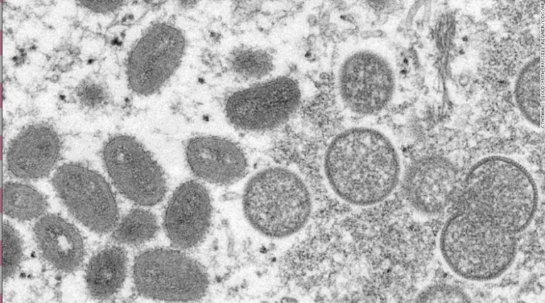 ¿Se puede convertir en pandemia? Los mitos y verdades de la viruela del mono