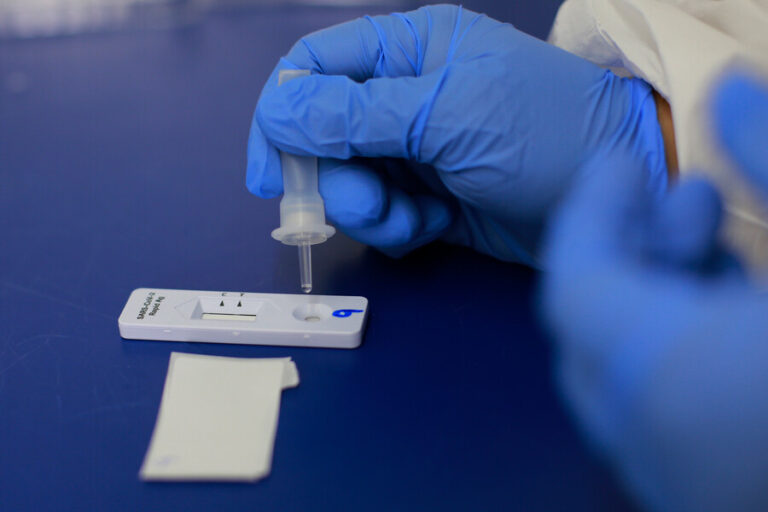 COVID-19: Minsal prepara resolución para que personas con test de antígeno positivo autoaplicado tengan licencia médica