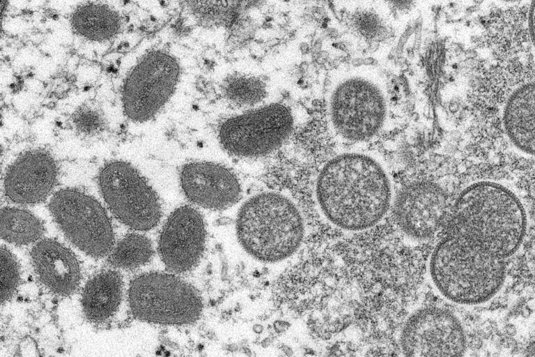 CDC: La transmisión aérea de la viruela del mono no ha sido reportada