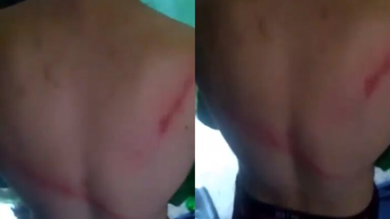 Juzgado de Garantía de Temuco acogió recurso del INDH por 23 internos que acusan golpizas