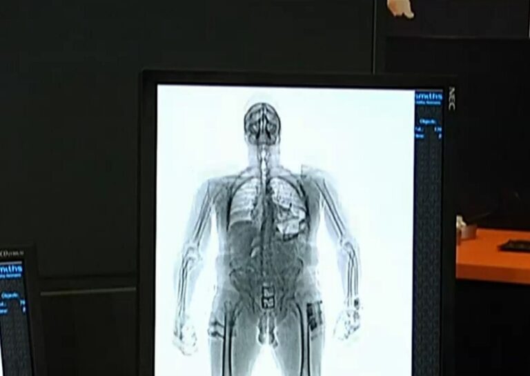 Tras críticas de Gendarmería: Minsal deja sin efecto medida que eliminaba los body scan en centros penitenciarios