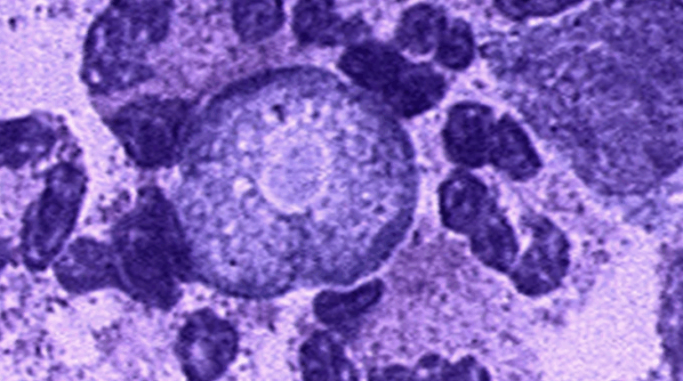 Potencialmente mortal: Playa de Iowa fue cerrada por caso de ameba comecerebros