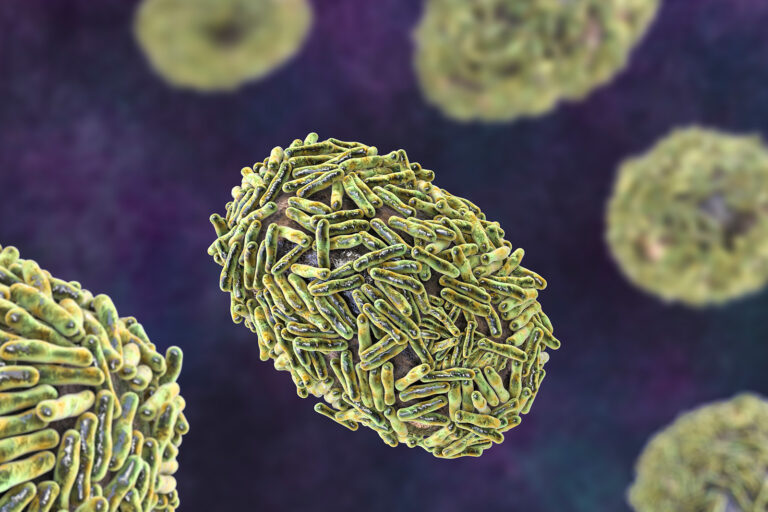 Sarpullido, fiebre, dolor de garganta y más: Estos son los principales síntomas de la viruela del mono