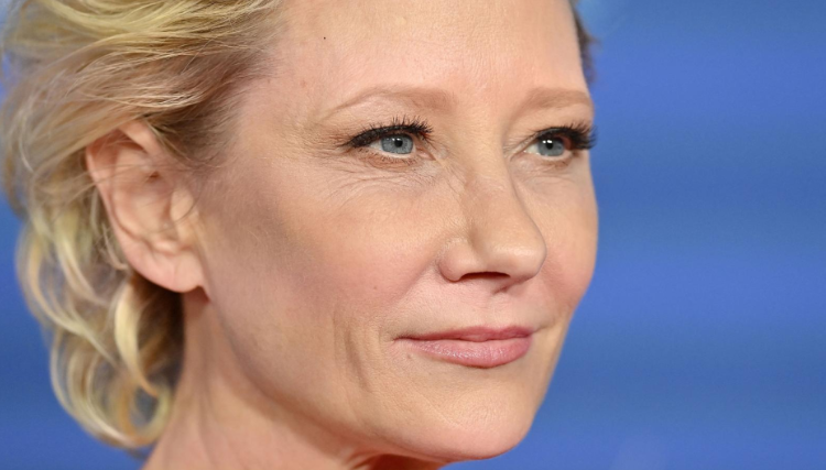 Anne Heche está en estado crítico tras accidente automovilístico que provocó un incendio