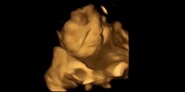 Las preferencias alimentarias podrían surgir incluso antes de nacer, sostiene un estudio