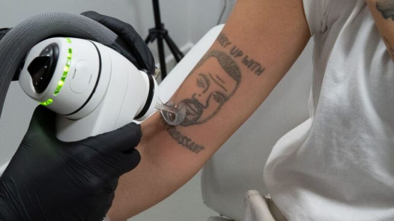 Estudio londinense elimina tatuajes inspirados en Kanye West gratuitamente
