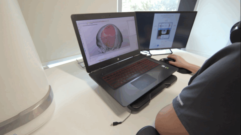 ArcomedLab, la vanguardista startup chilena que fabrica implantes craneofaciales