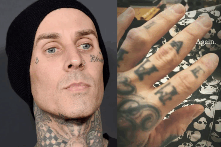 A un mes de Lollapalooza: Travis Barker, de Blink-182, se lesiona nuevamente el dedo