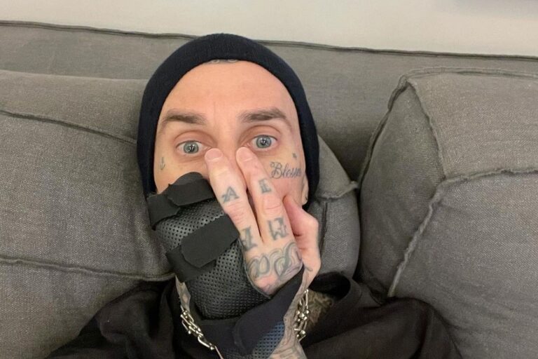 ¿Peligra Blink-182 en Lollapalooza? Travis Barker comparte registro de su dedo dislocado y anuncia que se operará