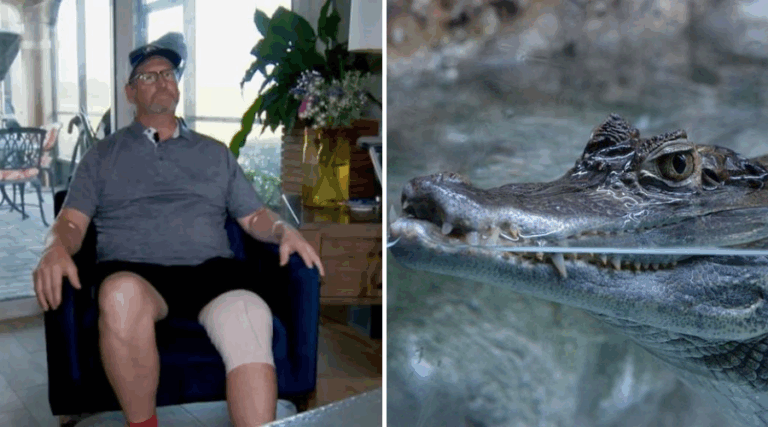 Hombre fue mordido por un caimán en Florida: Animal esperaba justo afuera de su puerta