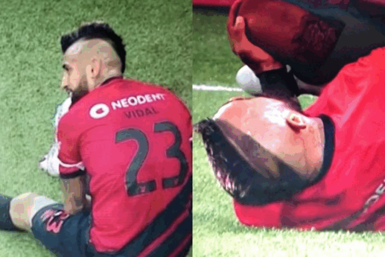 Alerta en La Roja: Vidal sale lesionado en partido del Paranaense a días de su debut en Clasificatorias