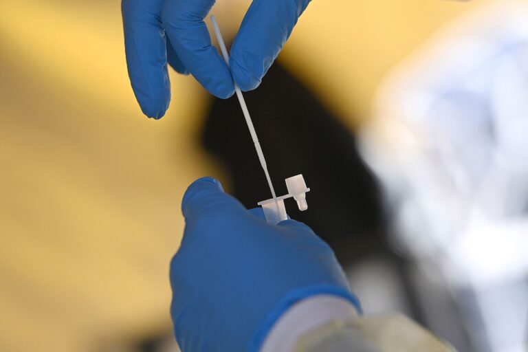 Primeras pruebas de laboratorio sugieren que la nueva variante del COVID-19 puede ser menos contagiosa de lo que se temía