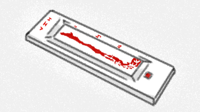 Mes de la lucha contra el sida: ¿Por qué aumentan los diagnósticos de VIH en Chile?