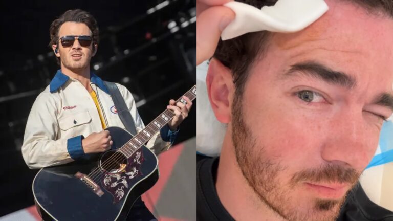 Kevin Jonas tuvo que someterse a una operación por cáncer de piel: 