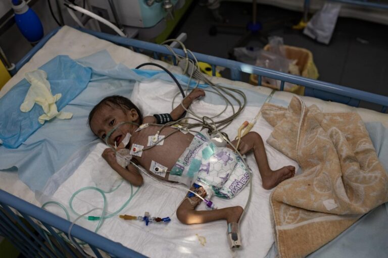 Expertos ONU sobre la muerte de niños por malnutrición en Gaza: 