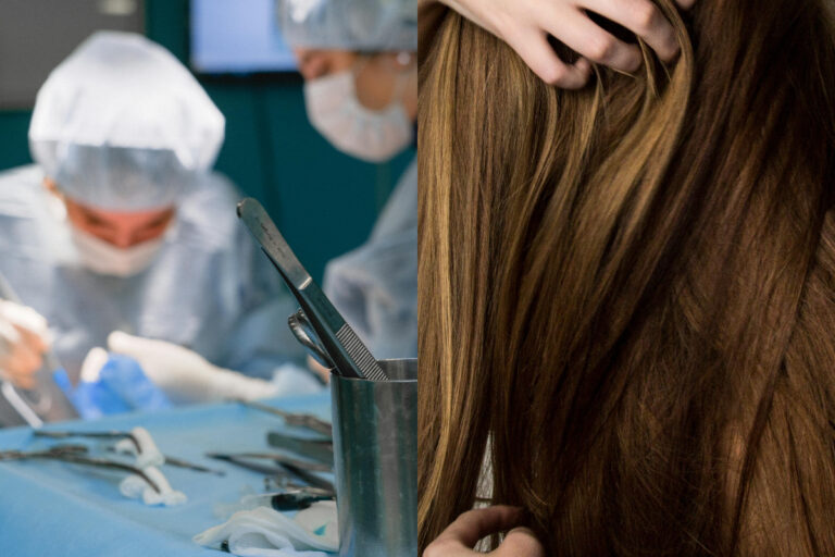 Extraen bola gigante de pelo del estómago de una joven de 24 años en Ecuador: 