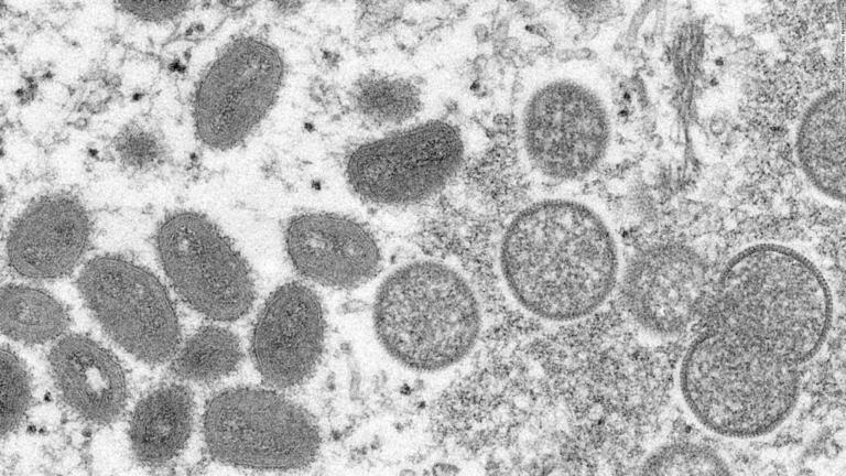 ¿Qué síntomas causa la viruela del mono, cómo se contagia y qué tratamiento tiene? Esto es lo que sabemos de la enfermedad