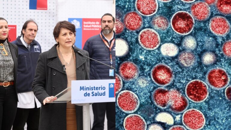 Ministerio de Salud declara alerta sanitaria por nueva variante de viruela del mono