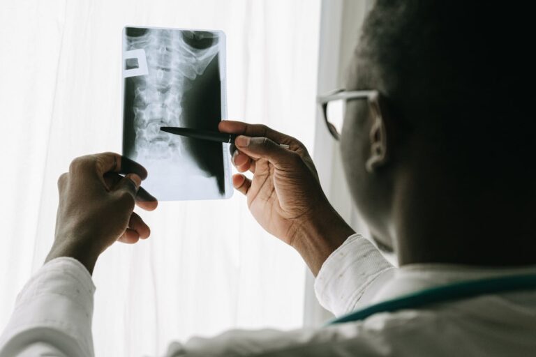 Cáncer de cabeza y cuello: Médico explica en qué consiste y cuáles son los factores de riesgo