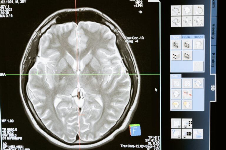 Neurólogo entrega recomendaciones: Las claves para mantener un cerebro sano