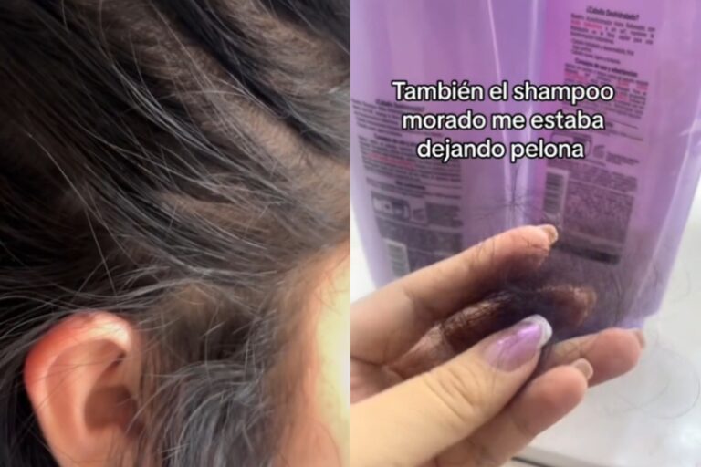 Tras oficio del Sernac por línea capilar que tendría fallas: L'Oreal descarta 