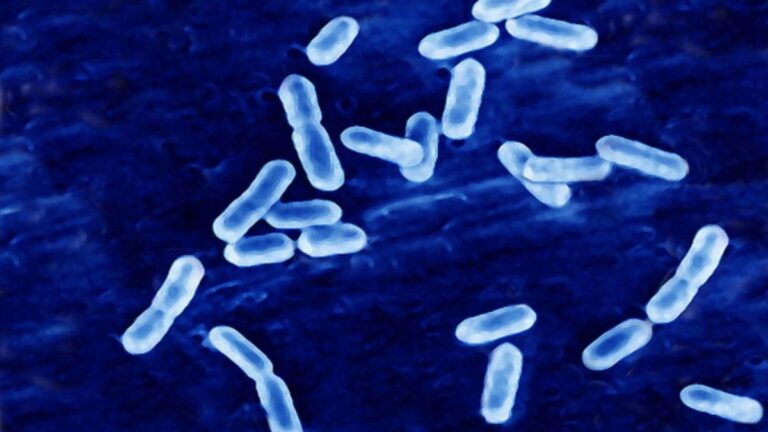 Tras alerta alimentaria del Minsal: ¿Qué es la listeria y cuáles son sus efectos en las personas?