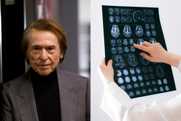 Enfermedad diagnosticada a Raphael: ¿Qué es un linfoma cerebral primario y cómo identificarlo?