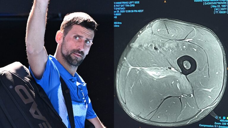 Tras polémico retiro del Australian Open: Djokovic publica resonancia magnética en sus redes y emplaza a 