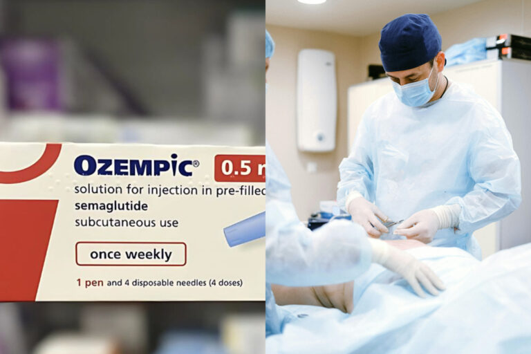 ¿Por qué hay cada vez más operaciones de reconstrucción corporal para las personas que usaron Ozempic?