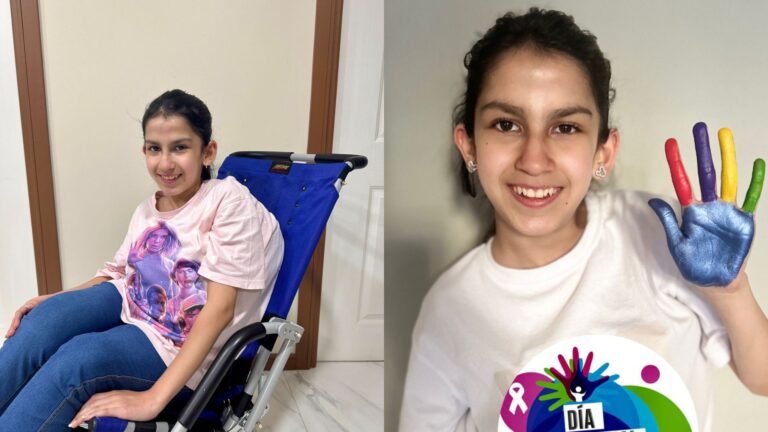 Día mundial de enfermedades raras: El desafío de Martina y su lucha contra el síndrome de CLOVES