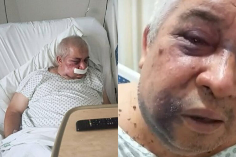 Denuncian brutal golpiza a conserje de 70 años por parte de empresario en Vitacura: Podría perder un ojo