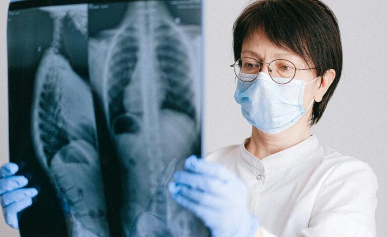 Cirujano de tórax aclara: ¿Cómo afecta el fumar a los pulmones?