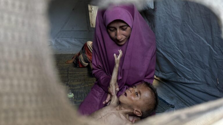 Cinco personas más murieron en Gaza en las últimas 24 horas debido al hambre: Dos de ellos eran menores
