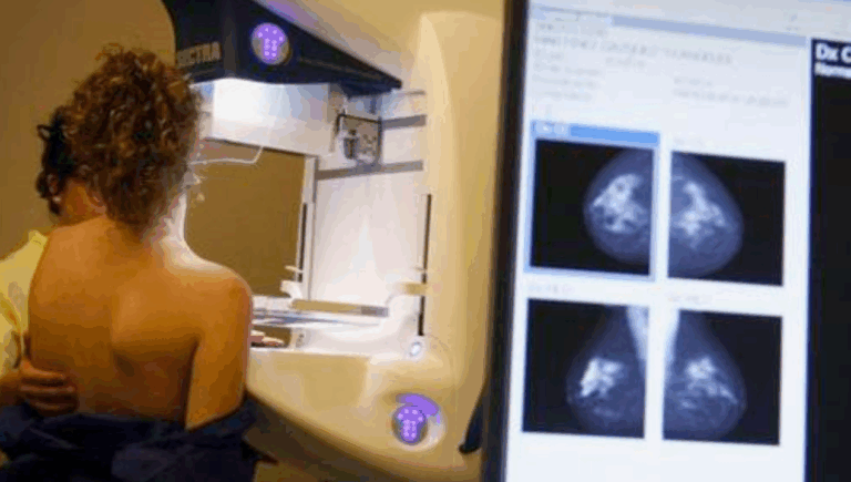 Tratamiento contra el cáncer de mama triple negativo será gratuito en el sistema público desde 2025