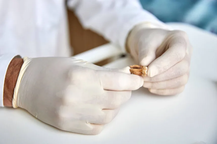 Los investigadores analizaron dientes de soldados encontrados en una fosa común descubierta en 2001 en Vilna, Lituania. Claudio Centonze/Comisión Europea