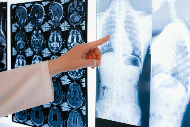 Estudio alerta alza del cáncer en menores de 50 años: ¿A qué factores podría deberse?
