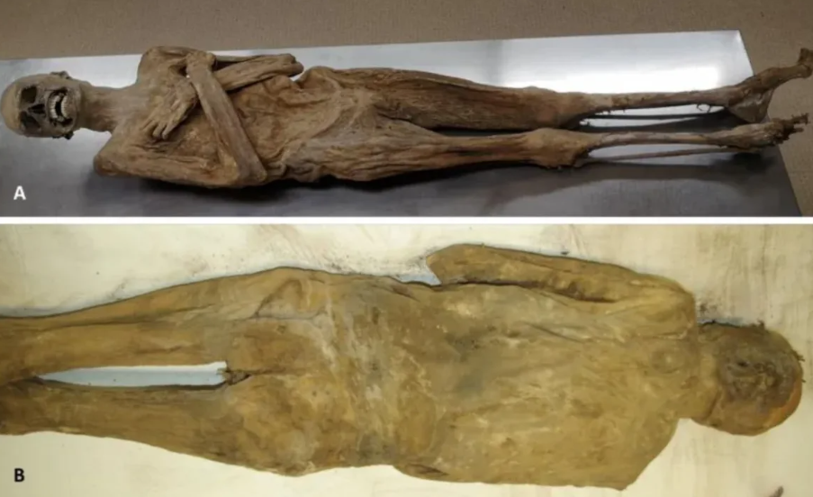 El aspecto externo de la momia, visto desde la parte frontal (A) y posterior (B), no presentaba incisiones en el cuerpo. Cortesía de Andreas Nerlich