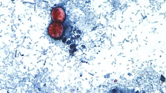 Reportan las primeras muertes en EE.UU. relacionadas con el brote de diarrea explosiva por ciclosporiasis
