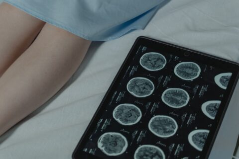 Cáncer de tiroides: Experto explica los principales factores de riesgo, señales de alerta y quiénes tienen mayor prevalencia