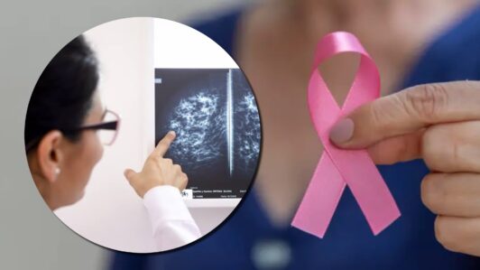 Cáncer de mama en mujeres jóvenes: Iniciativa destinará US$15 millones a investigación internacional