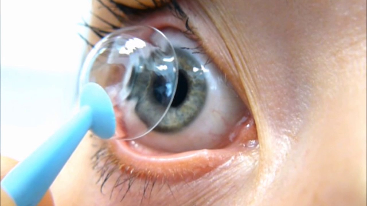 Hacer las tareas domésticas calendario sentido Alerta por aumento de casos de una rara infección en los ojos por usar  lentes de contacto
