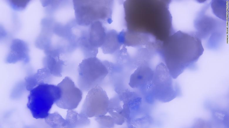 Foto: Una vista ampliada de las partículas de lapislázuli incrustadas en la placa dental
